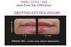 novexpert | Lip'Up | Trattamento Labbra rimpolpante Acido Ialuronico