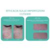 Gel detergente viso pelle impura MINI SIZE Trio Zinc Novexpert | Gelée moussante peau nette MINI SIZE Trio Zinc